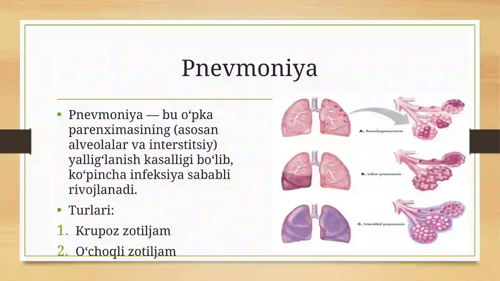 Pnevmoniya 2