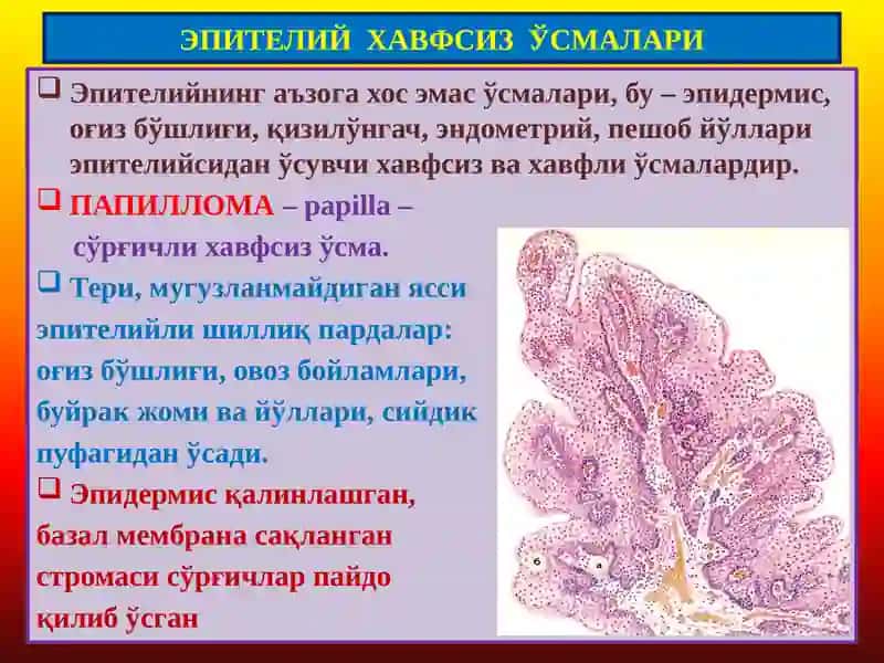 Ўсмалар. Мезенхимал ўсмалар 2