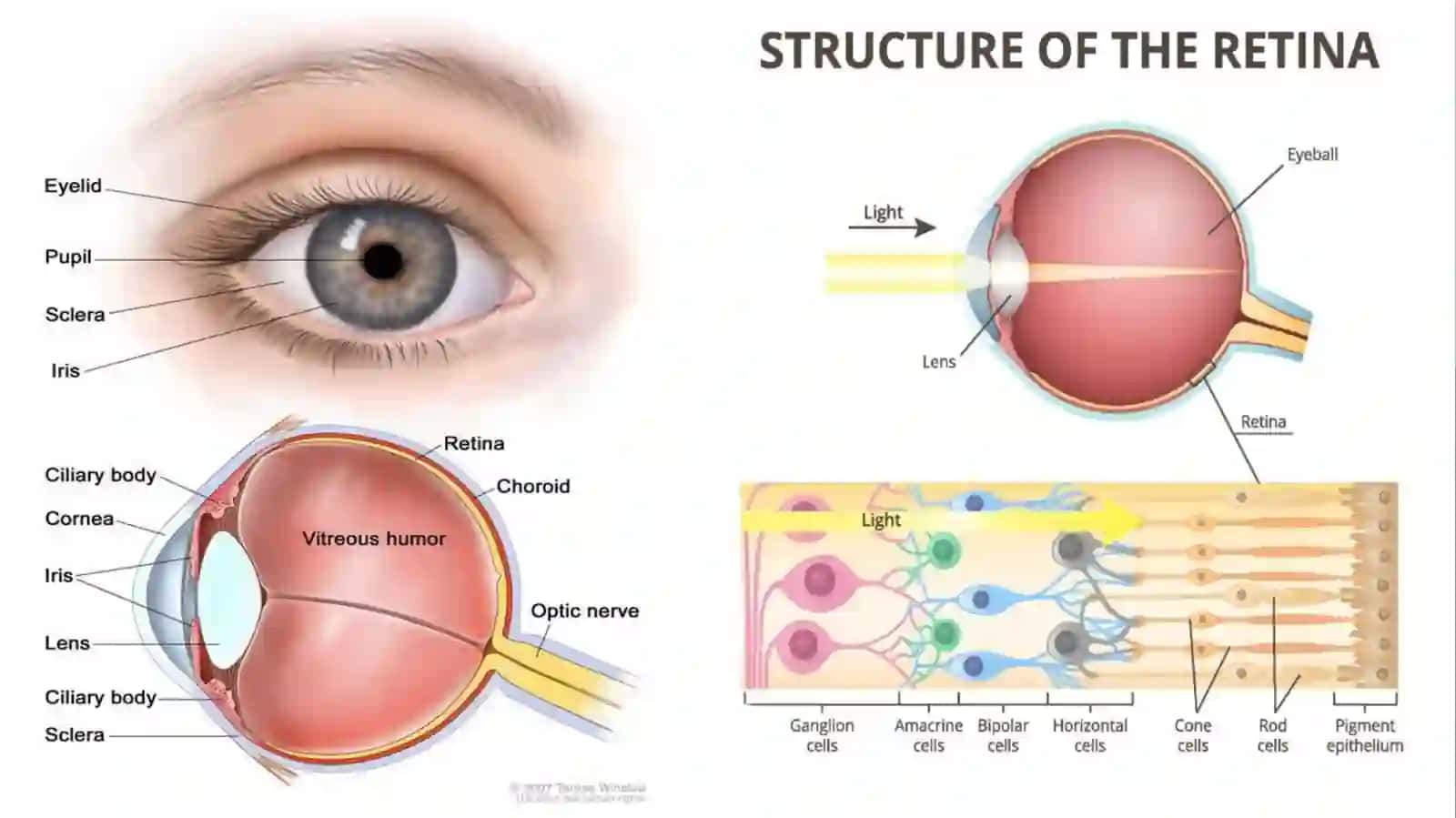 Retinoblastoma 2