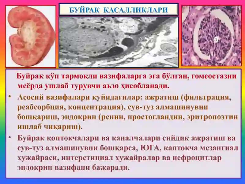 Буйрак касалликлари 2