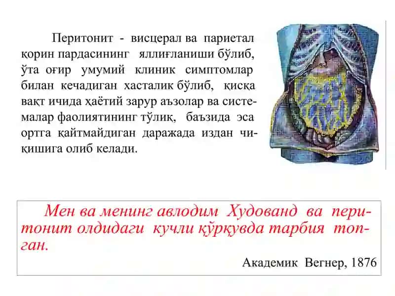 Перитонит 2