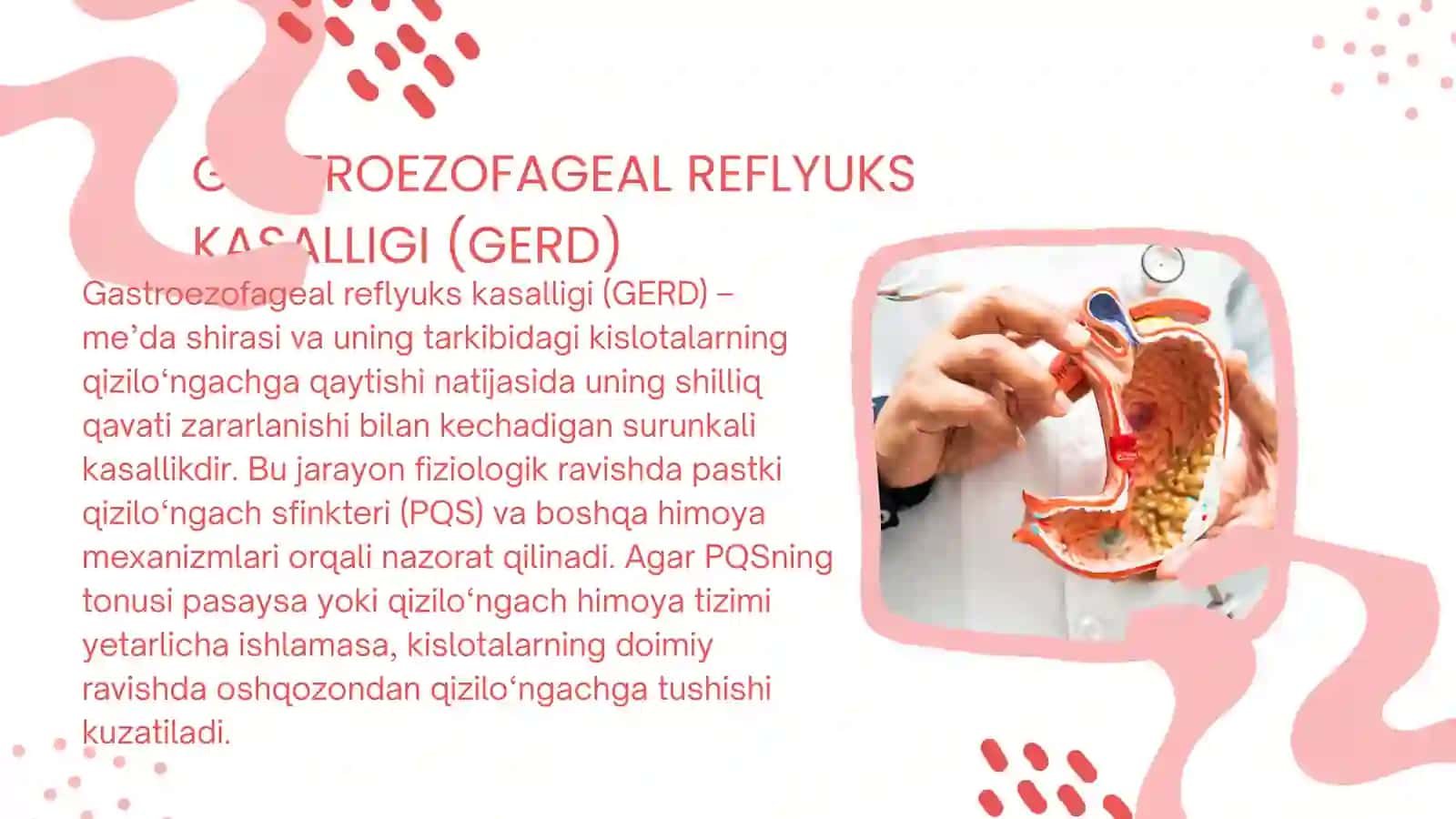 Gastroezofagal reflyuks 2