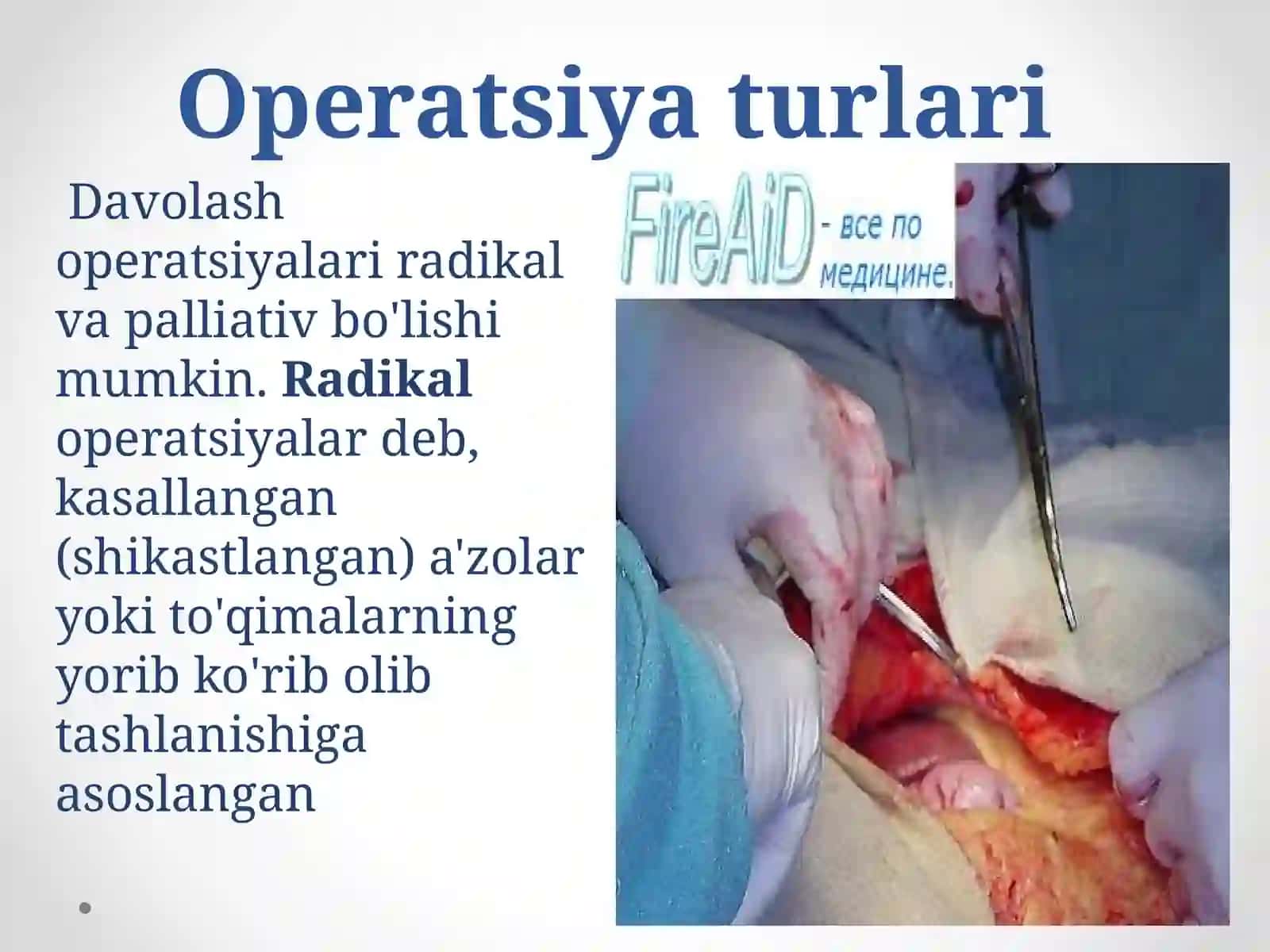 Operatsiya turlari 2