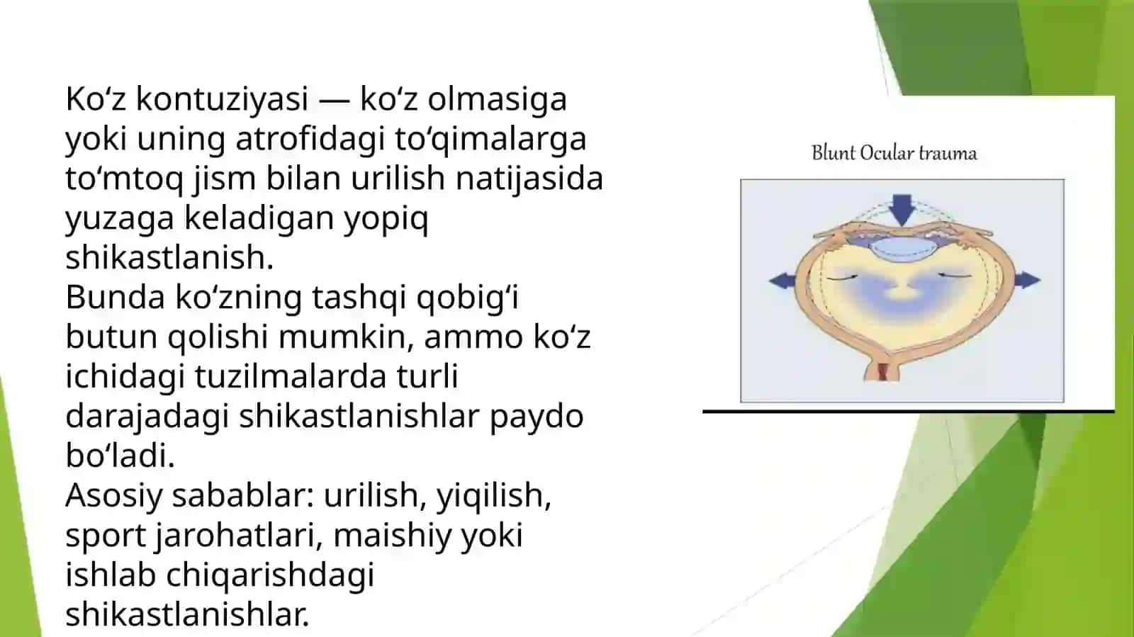 Ko’zkontuziyalari 2