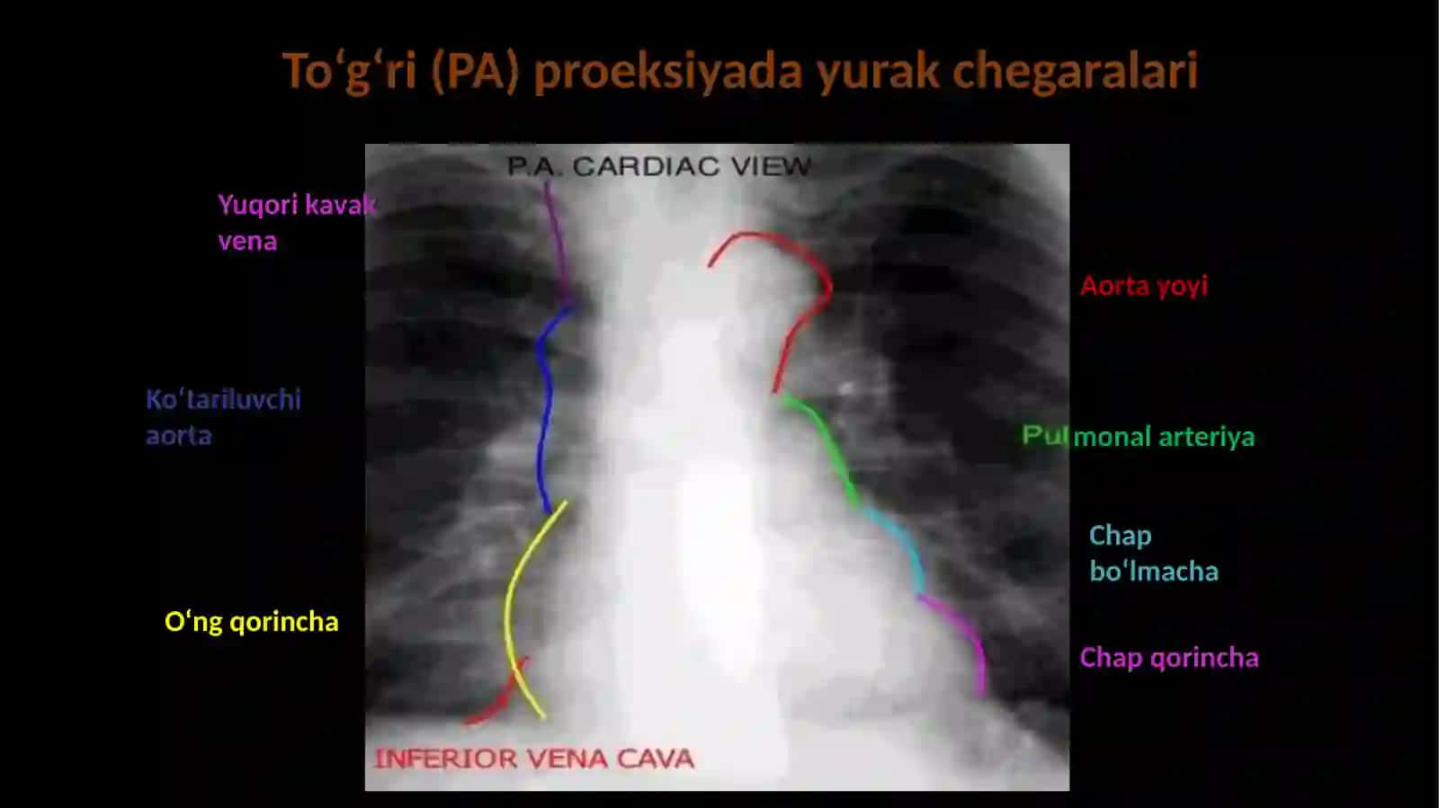 Yurak rentgenografiyasi 2