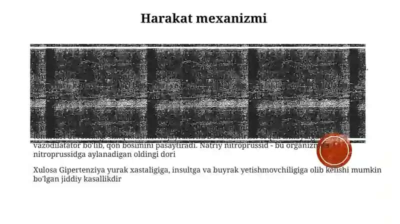 Gipertonik Krizda Ishlatiladigan Dori Vositalar 2