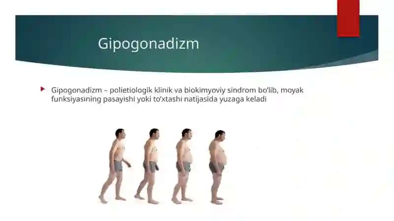 Gipogonadizm 2