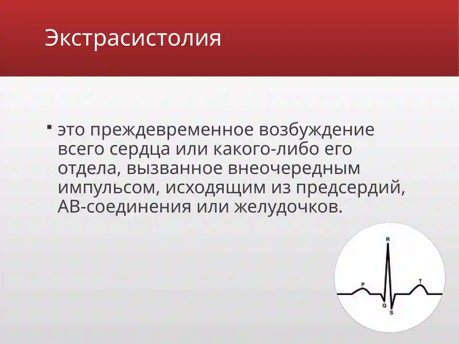 Ekstrasistoliya 2