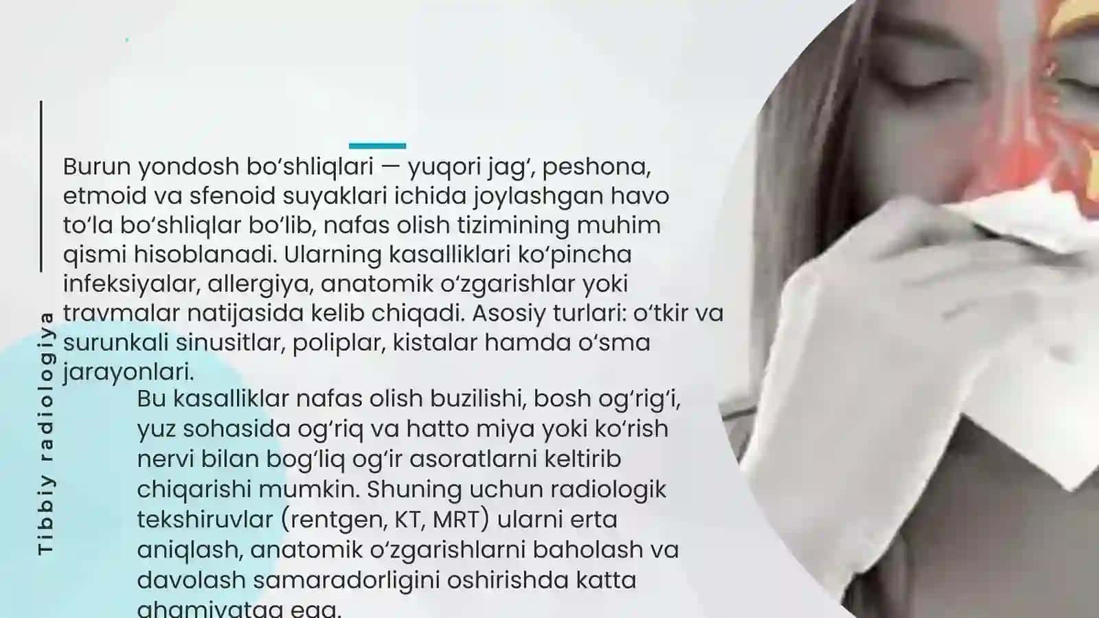 Burun yondosh bo'shliqlari kasalliklarining nur tashxisi 2