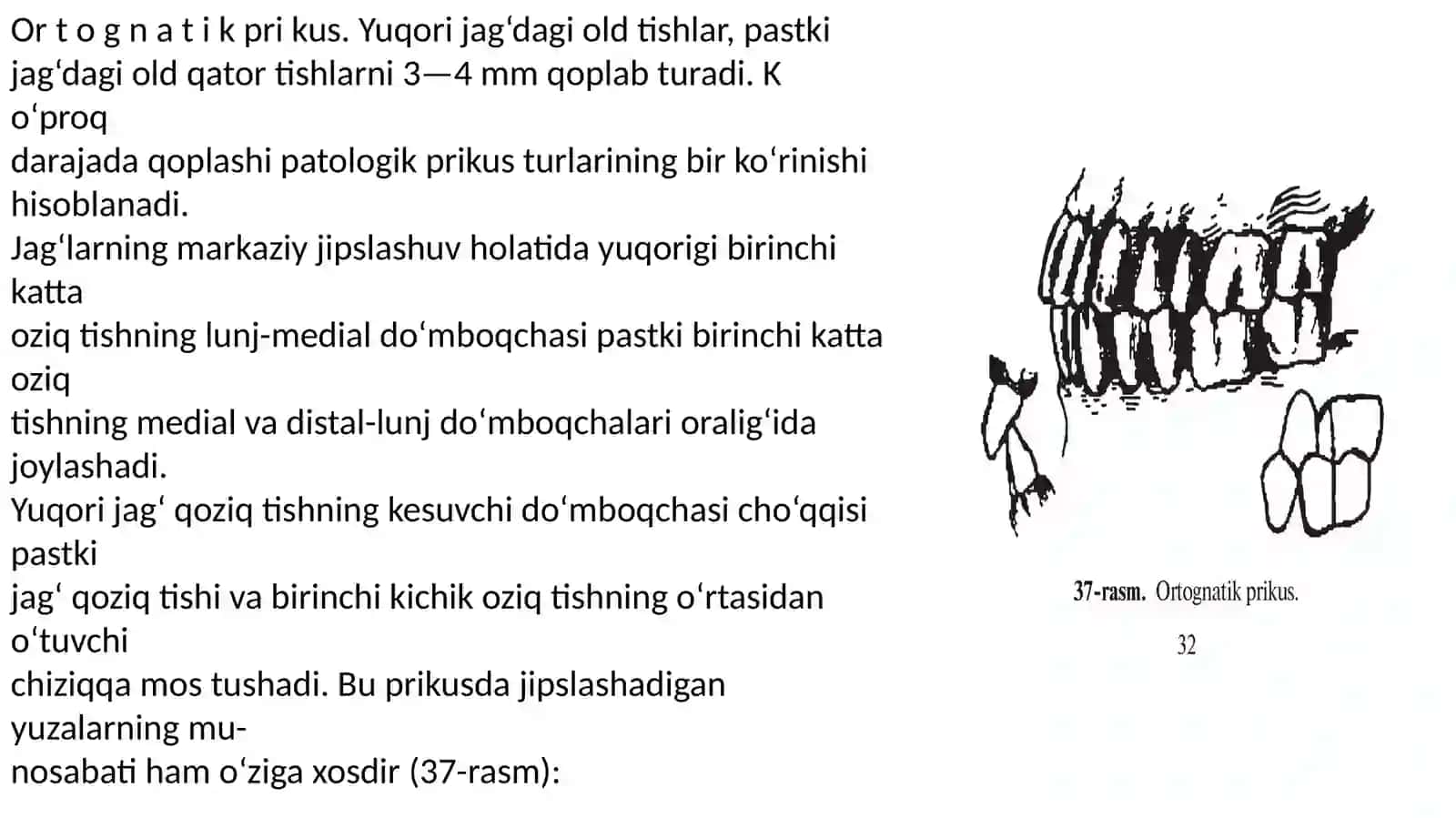 Ortopedik Stomatologiya Tish prikuslari. 2