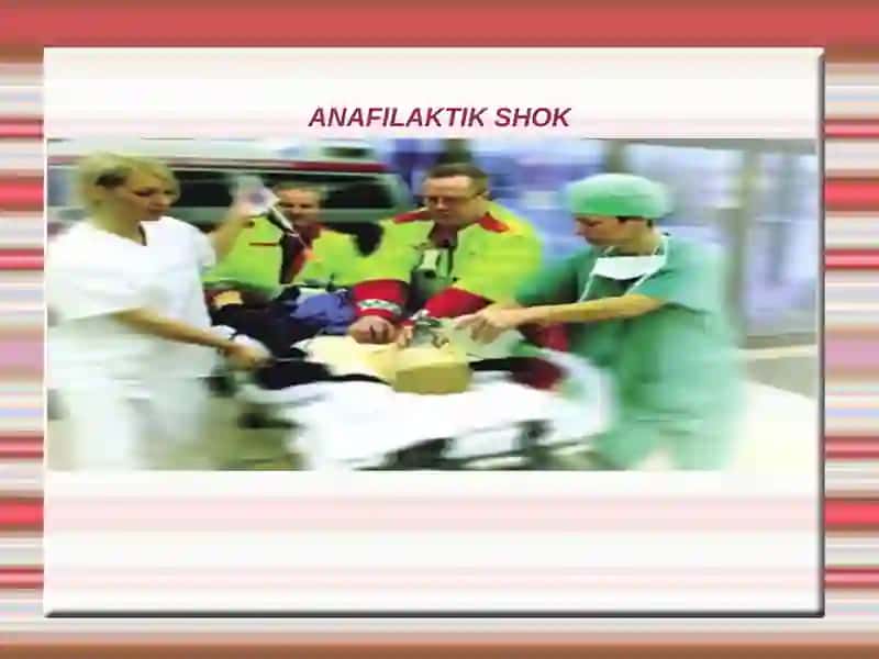 Anafilaktik Shok 2