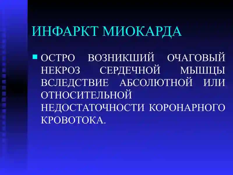 ИНФАРКТ МИОКАРДА 2