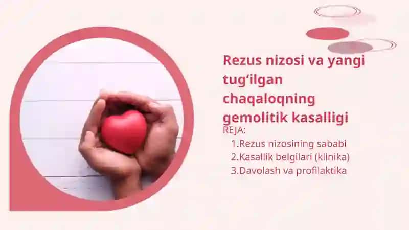 rezus nizosi 2