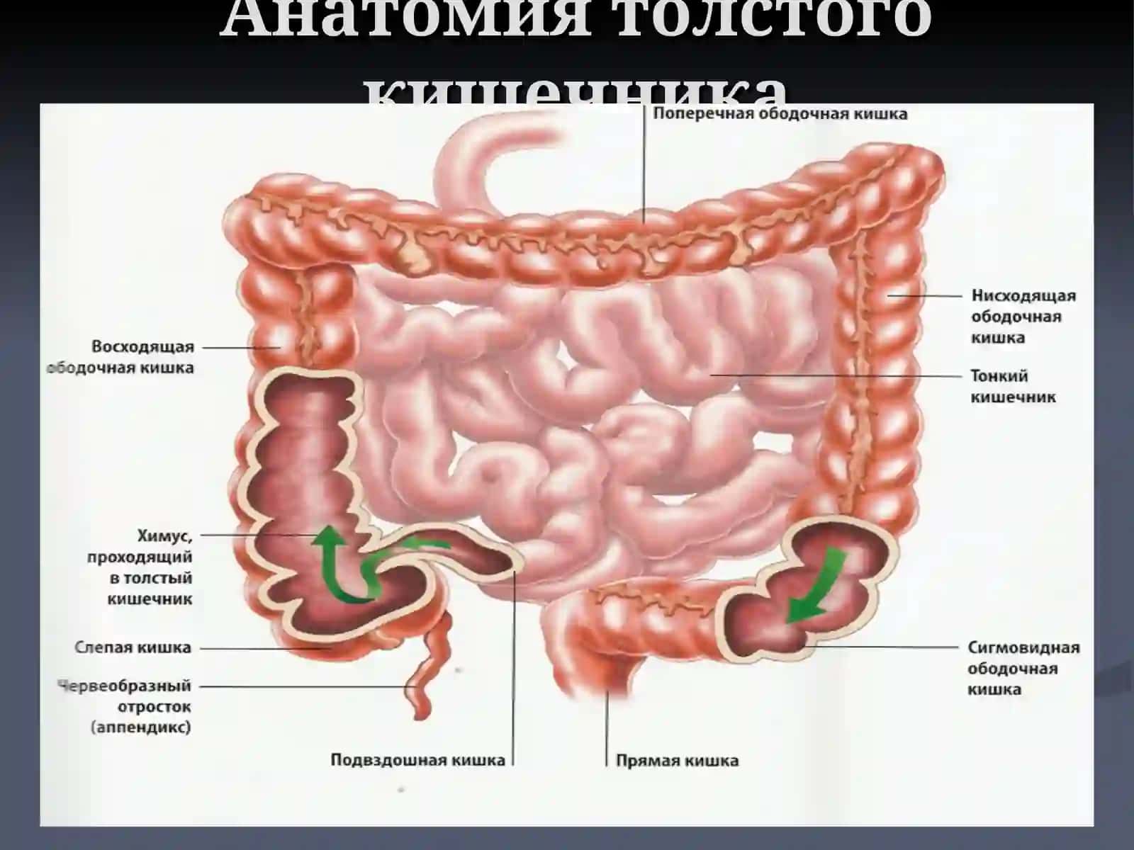 Неспецифический язвенный колит 2