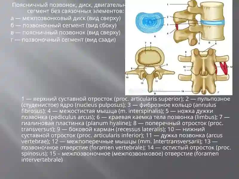 Остеохондроз 2