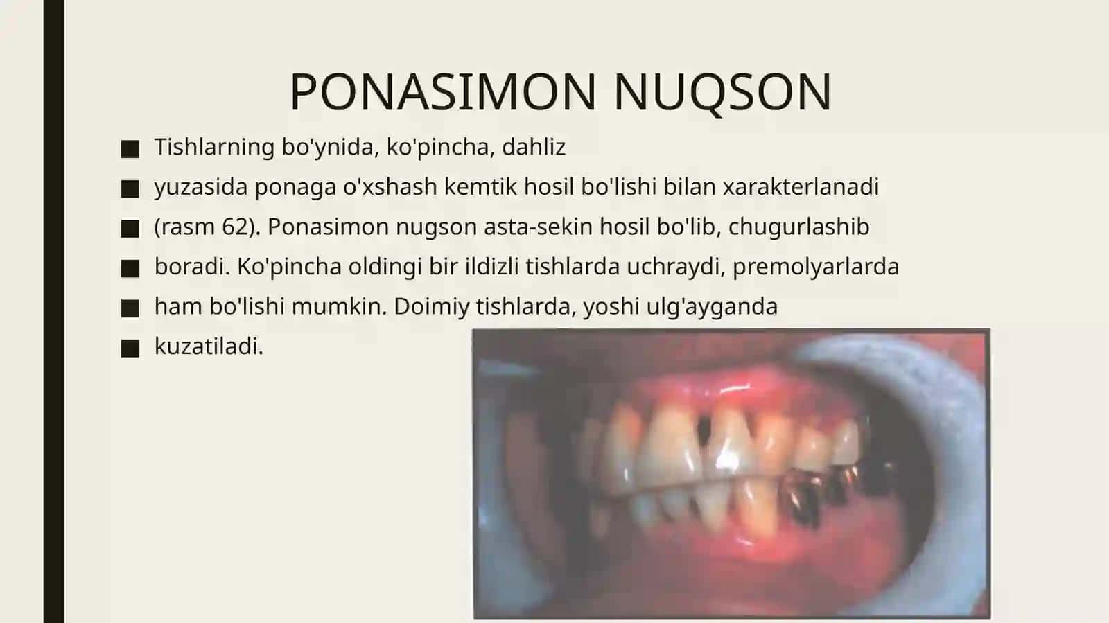 Tishchiqqandankeyin paydo bo`ladigan nokarioz kasallaiklar 2