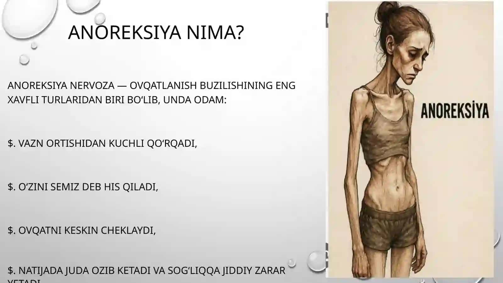 Anoreksiya 2