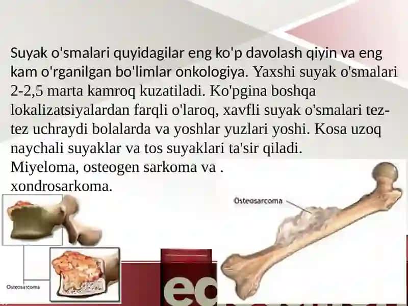 Harakat-tayanchtizimidaog'riqlisindromi.Harakat-tayanchtizimidao'smakasalliklari 2