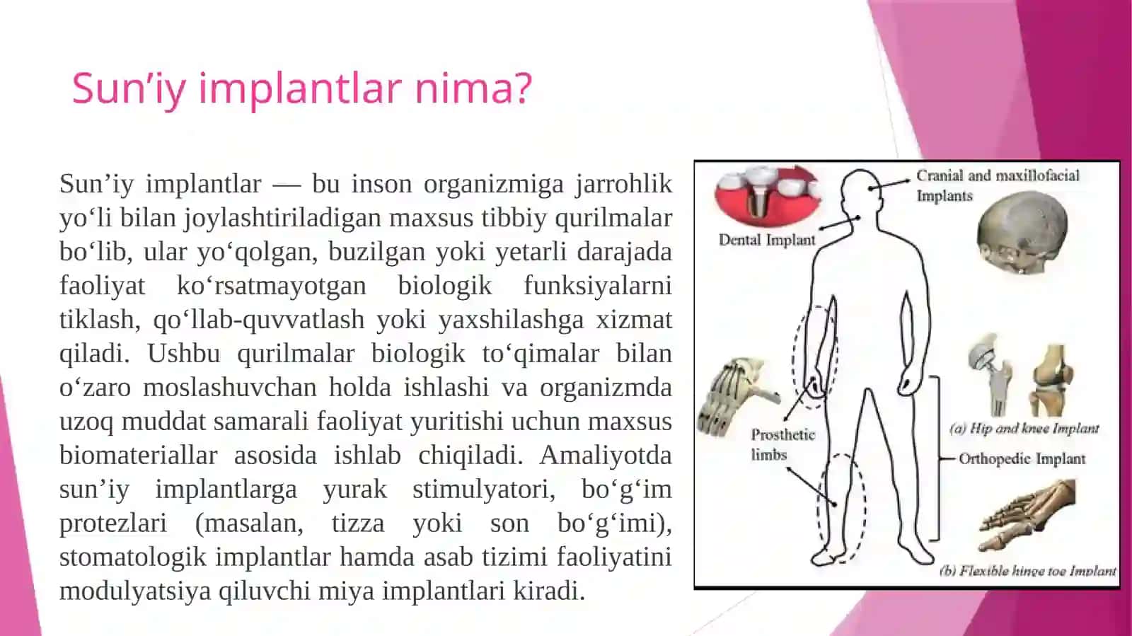 Sun’iy implantlardizayni va AK Torqali uxlarni monitoring qilish 2