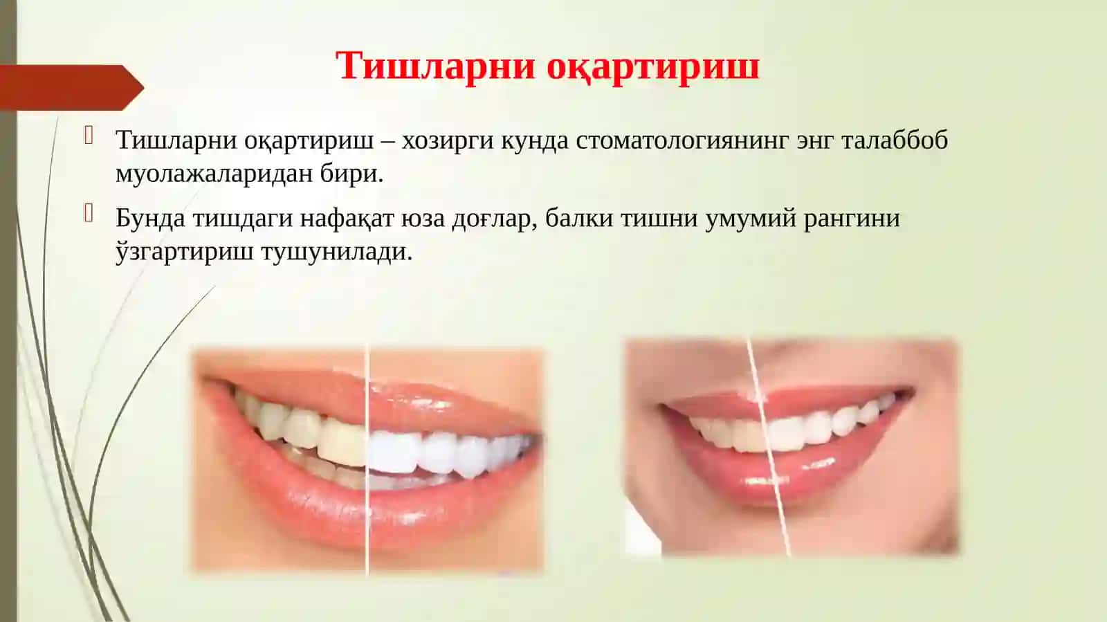 Тишларниоқартириш 2