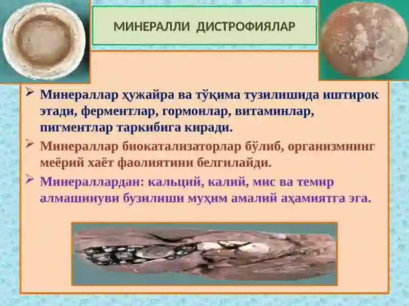 МИНЕРАЛЛИ ДИСТРОФИЯЛАР 2