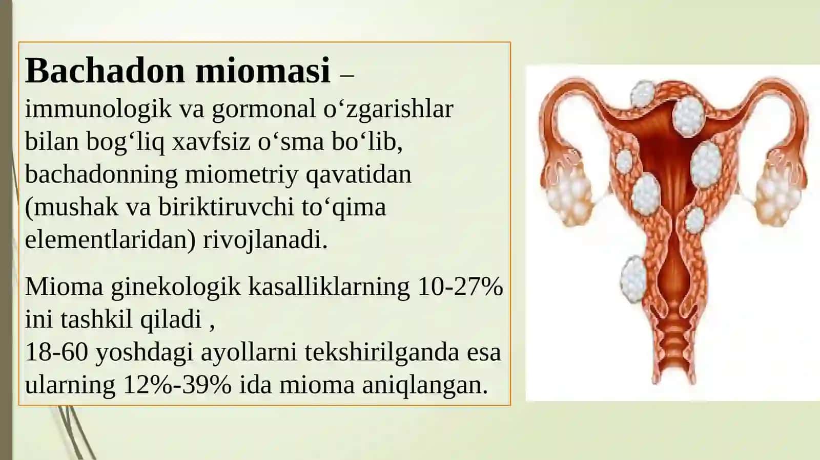 Bachadonmiomasi.Endometrioz 2