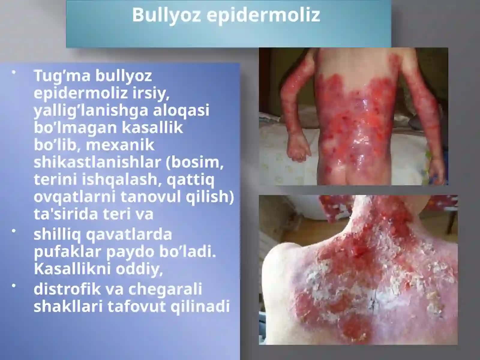 SamMITeri va tanosil kasalliklari kursi 2