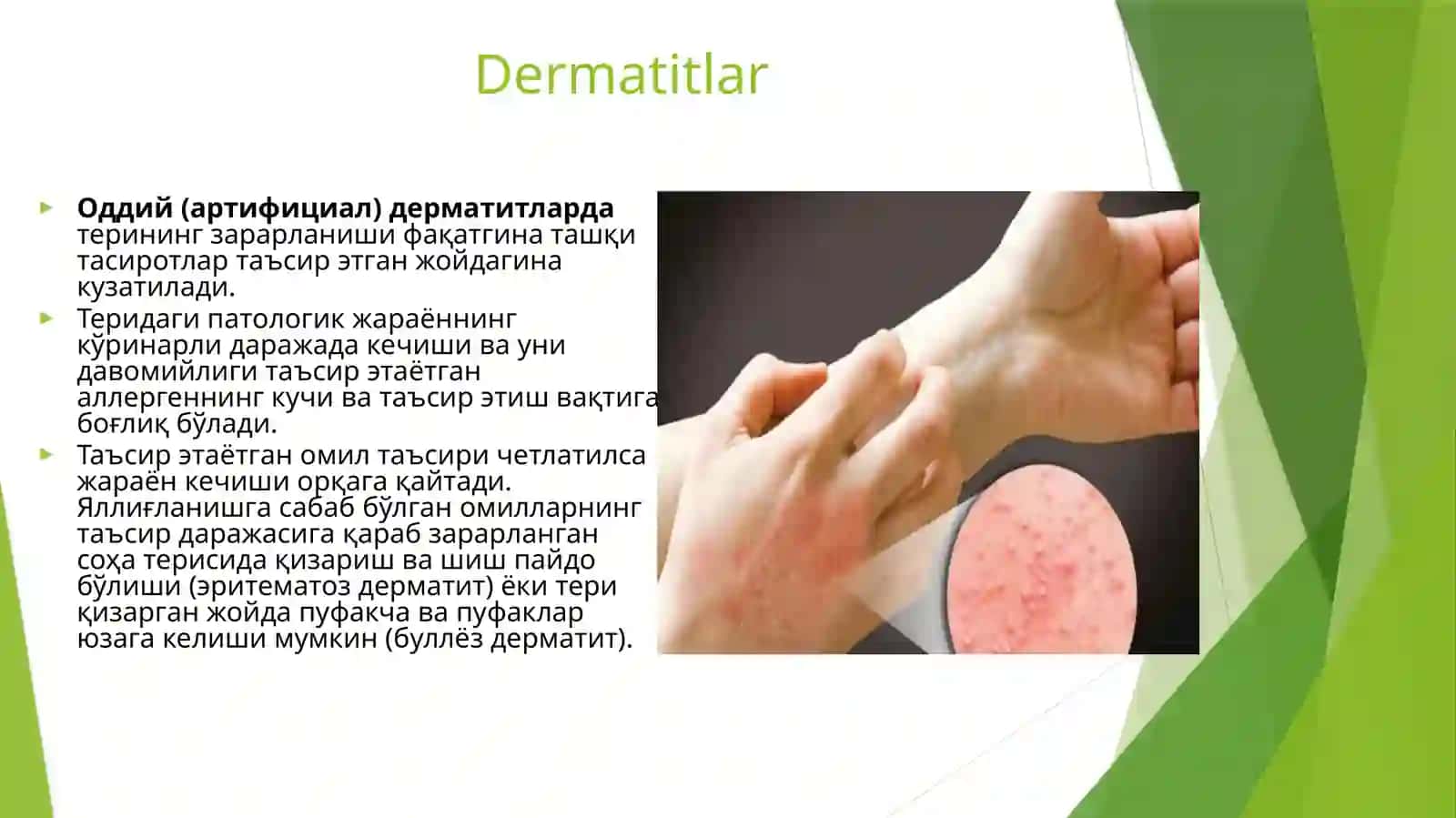 Allergadermatoz 2
