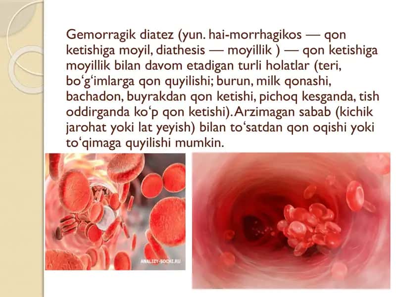 Gemorragik diatezlarning ko’rinishlari 2