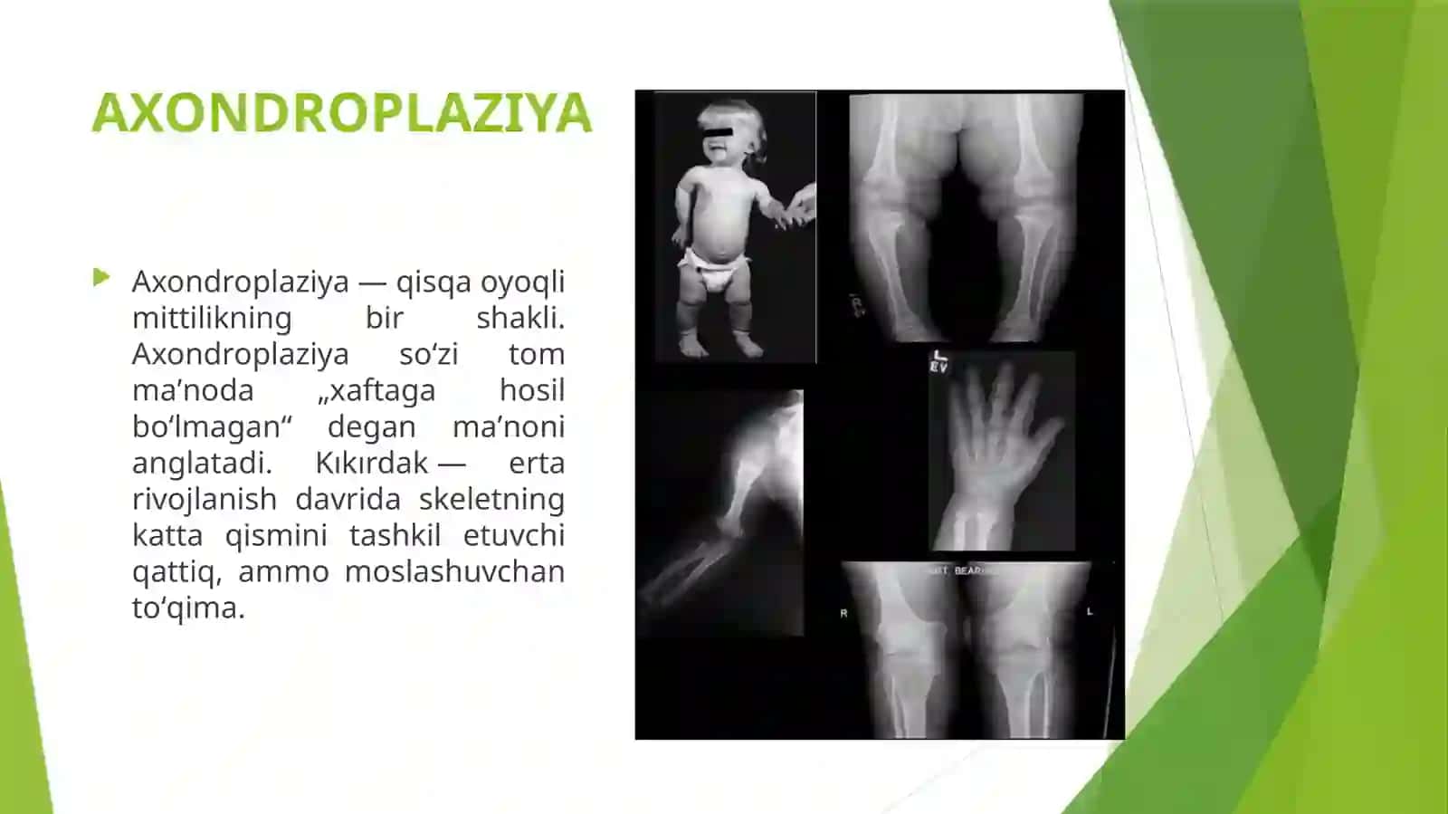 AXONDROPLAZIYA 2
