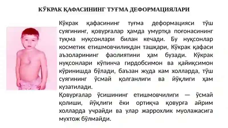 Кўкрак қафаси ва ўпканинг туғма ривожланиш нуқсонлари ва аномалиялари 2