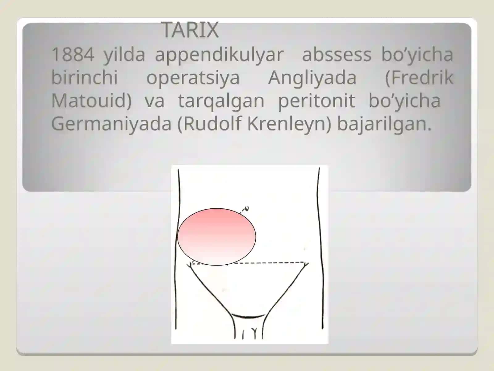 O‘tkir appenditsit asoratlari 2