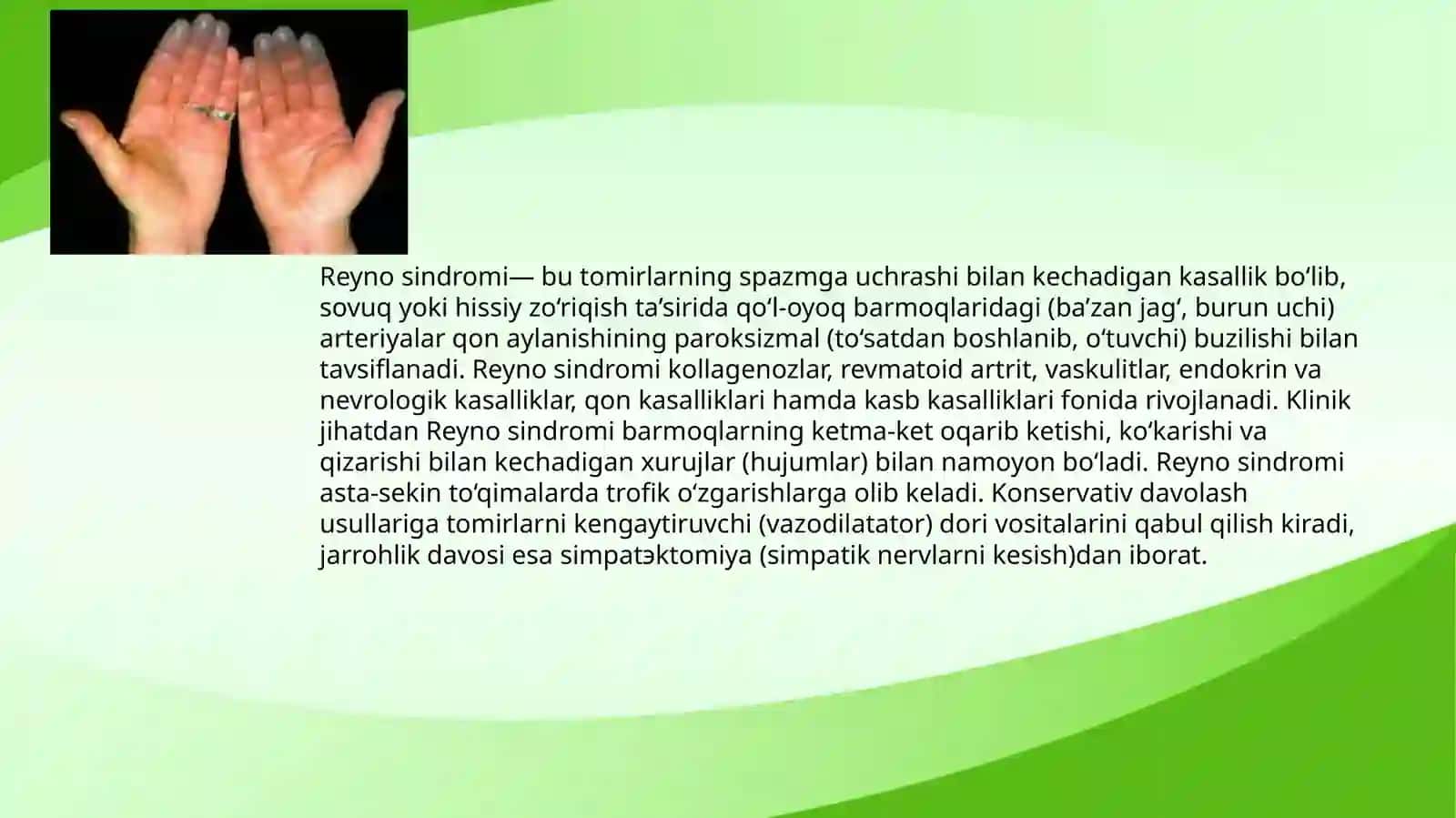 Reyno kasalligi 2