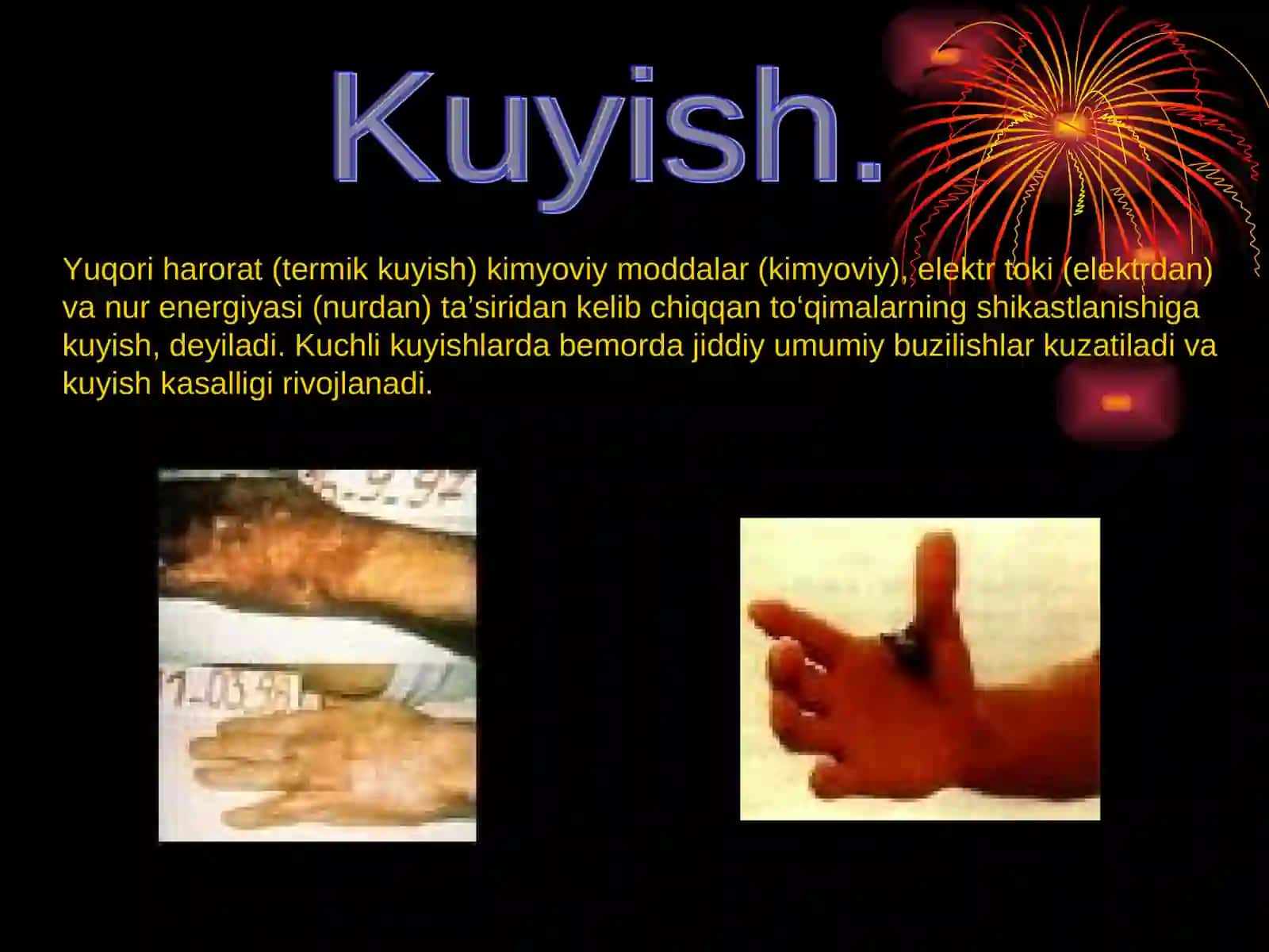 KUYISH DARAJALARI 2
