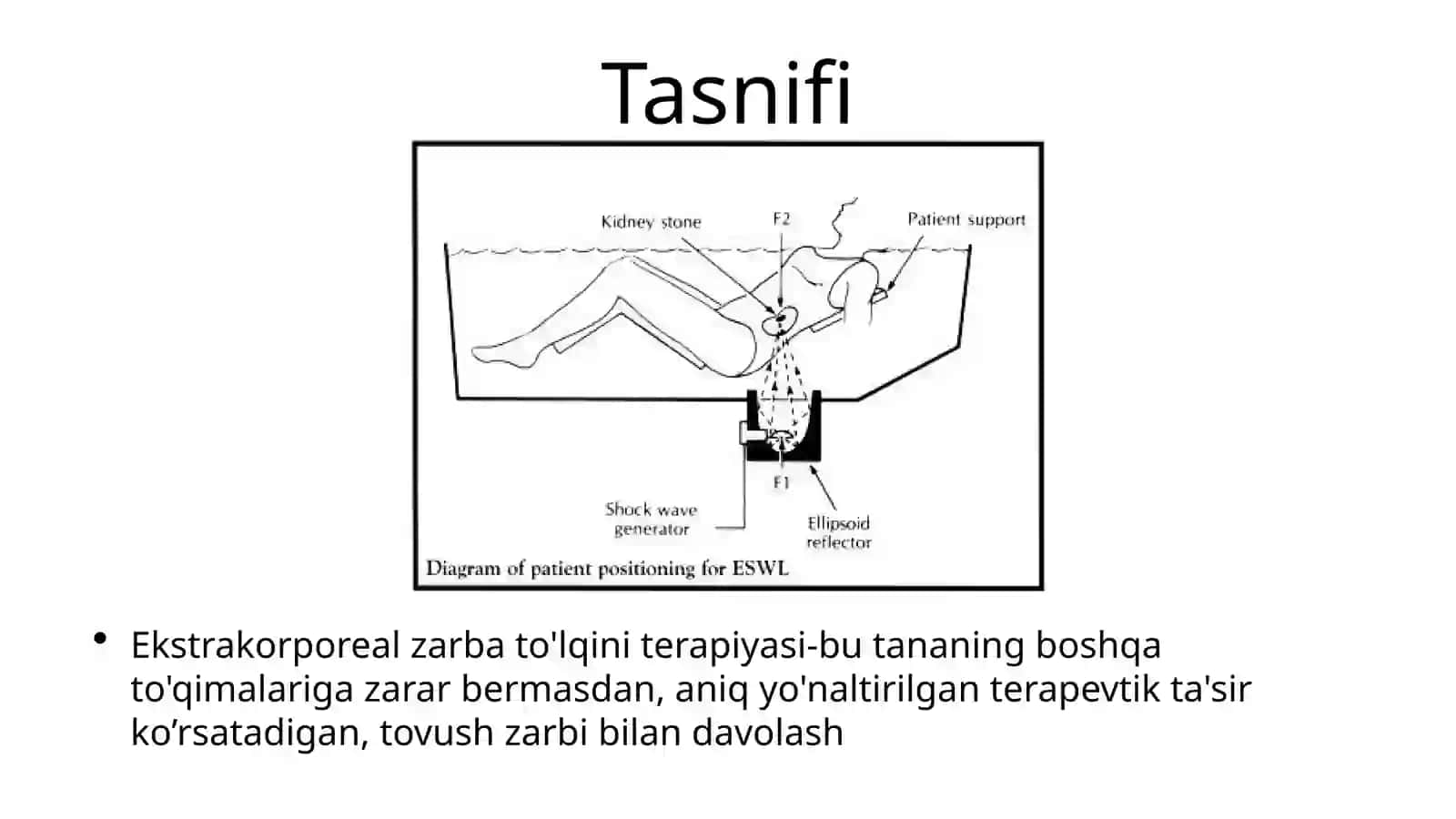 Ekstrokorporal zarb to’lqinli litotripsiya 2