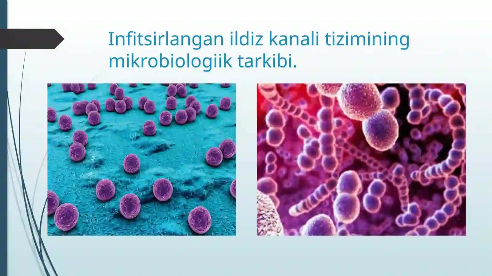 Infitsir langan ildiz kanal tizimi 2