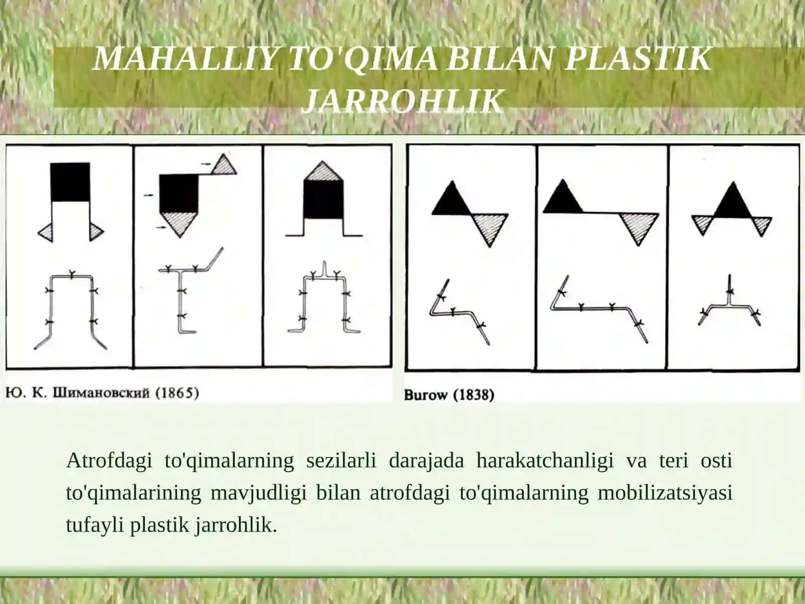 Mahalliy to‘qimalar bilan plastika qilish: Limberg uchrashuvchi uchburchakli laxtaklar. Ko’rsatmalar. Turlari va o‘tkazish prinsiplari. 2