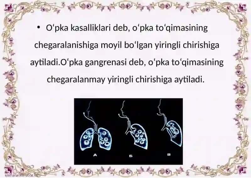 SOMATONEVROLOGIK SINDROMLAR (O’PKAKASALIKLAR) 2