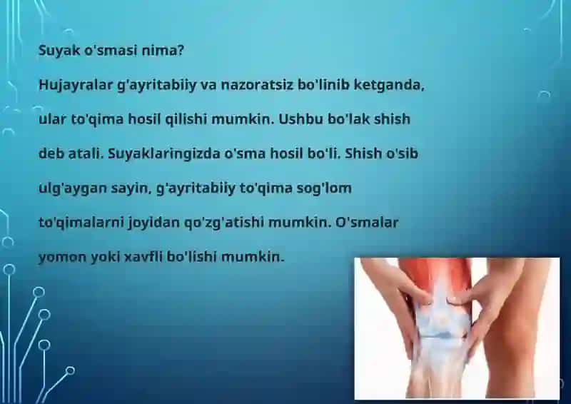 Suyak to'qimasi o'smalari 2