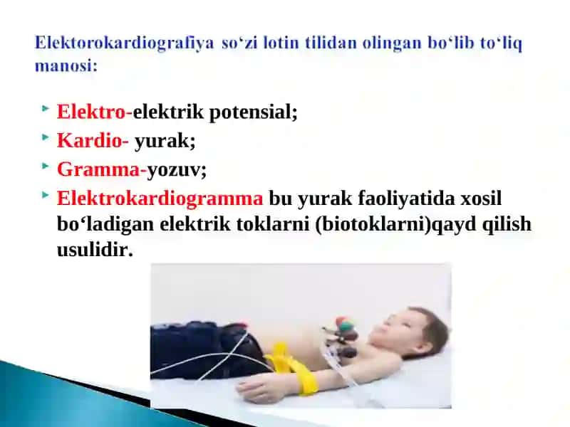 Elektrokardiogramma 2