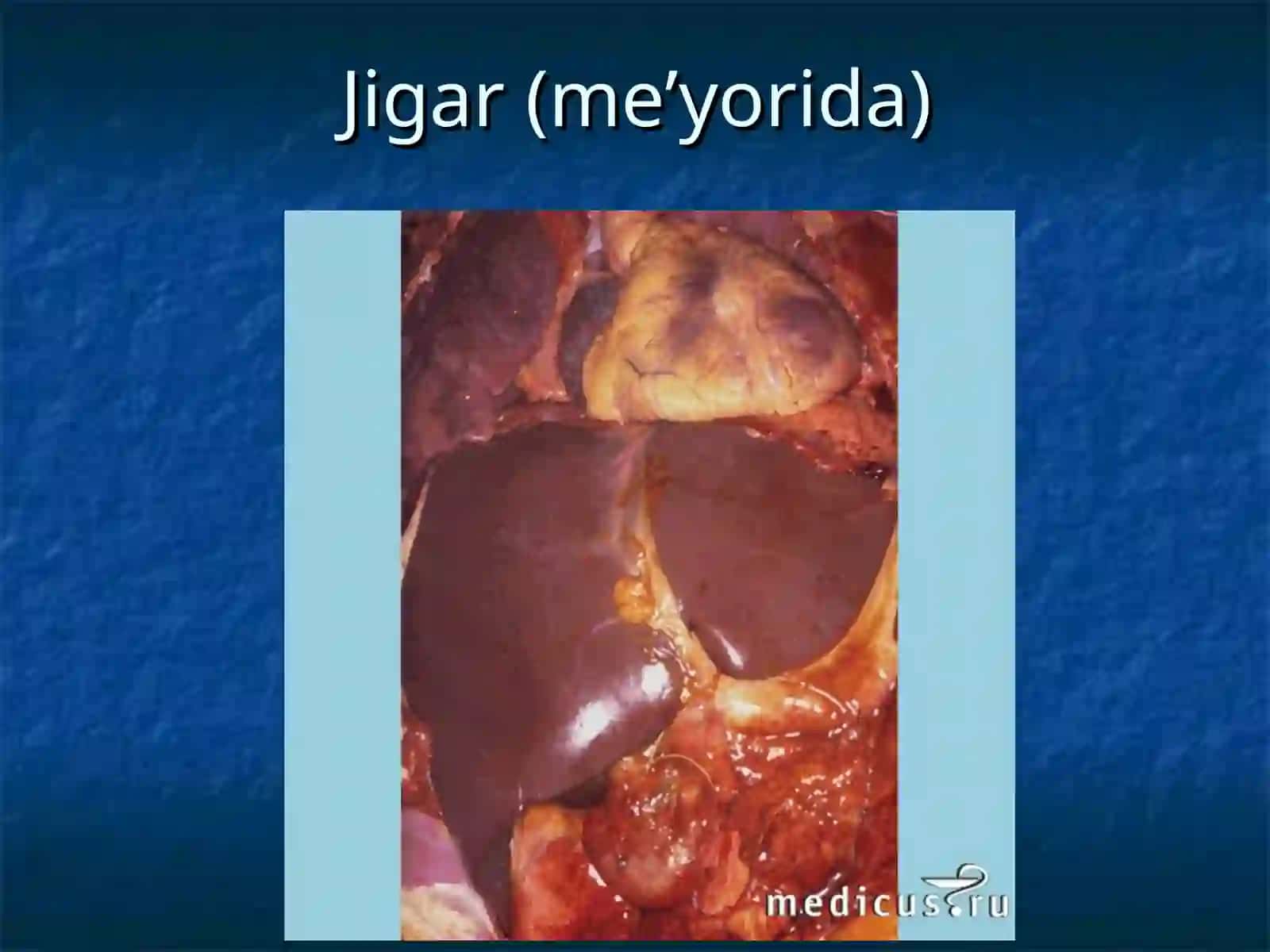 JIGAR SIRROZI 2