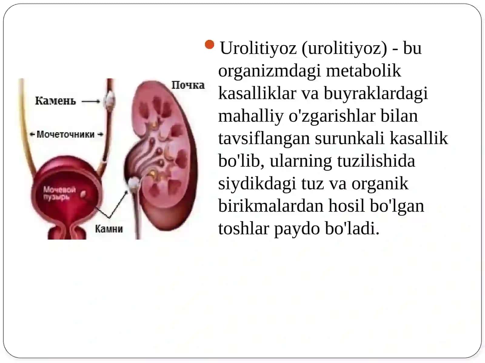 Siydik tosh kasalligi. Urolitiaz 2