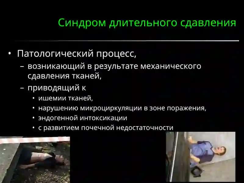 Синдром длительного сдавления 2