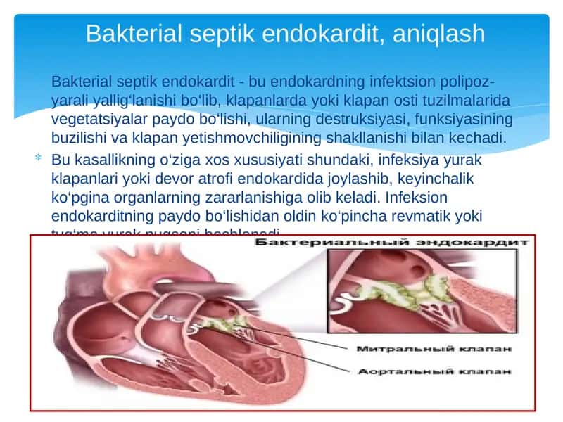 Septik endokarditning siptomatologiyasi 2