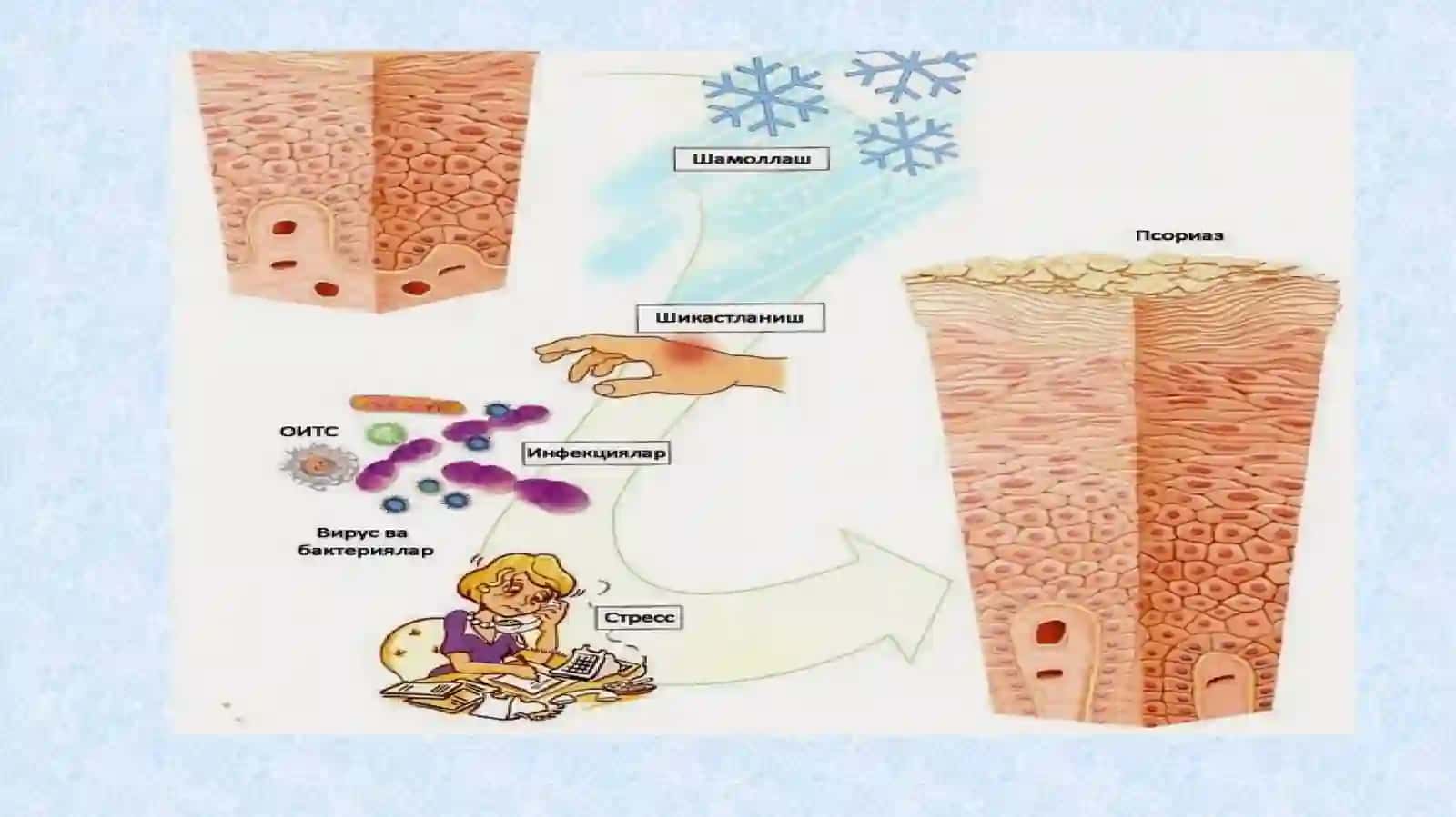 JIBERNING PUSHTI RANGLI TEMIRATKISI (PITYRIASIS ROSEA GIBERT) 2