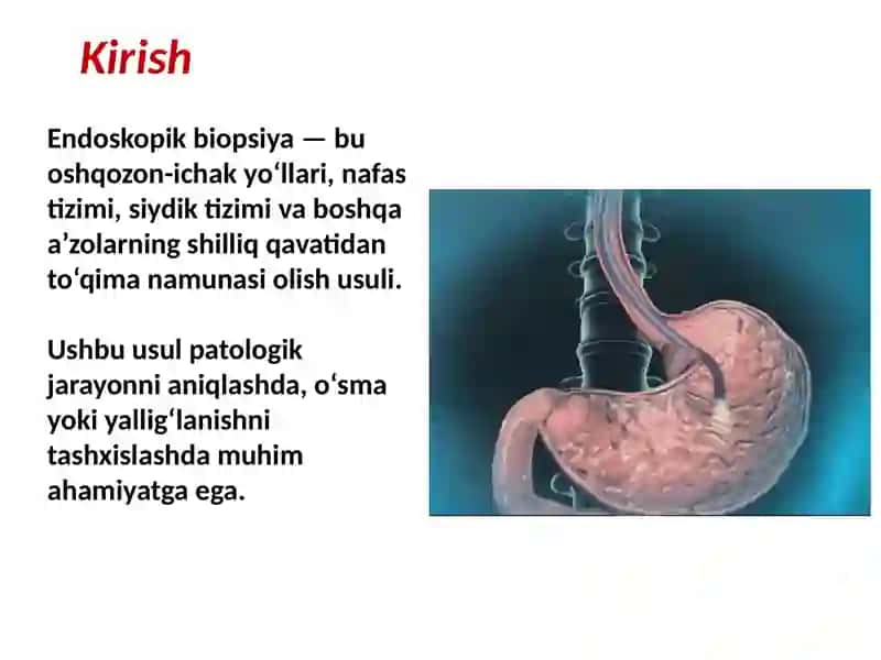 Endoskopik biopsiya 2