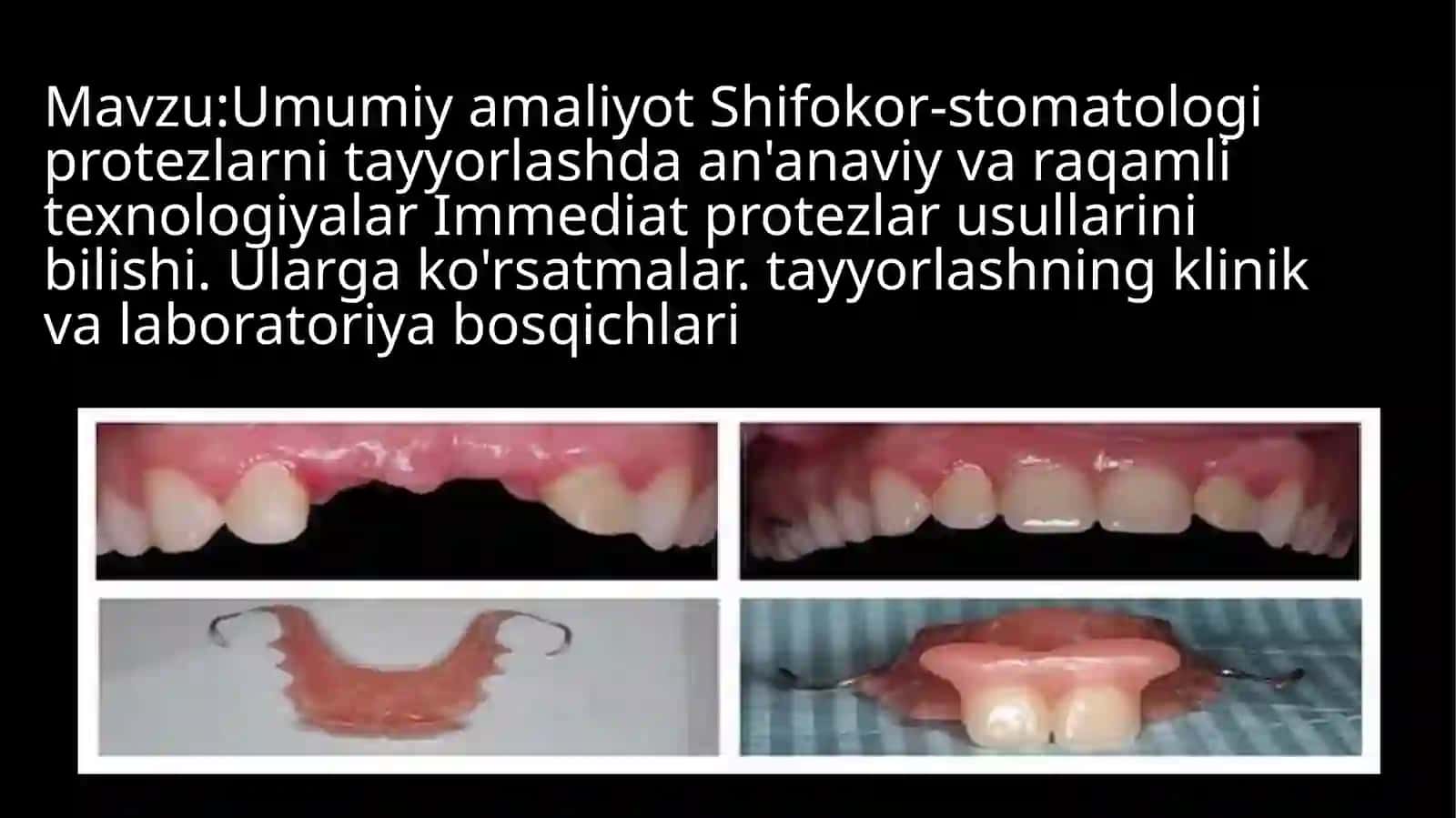 Immediate protezlari 2