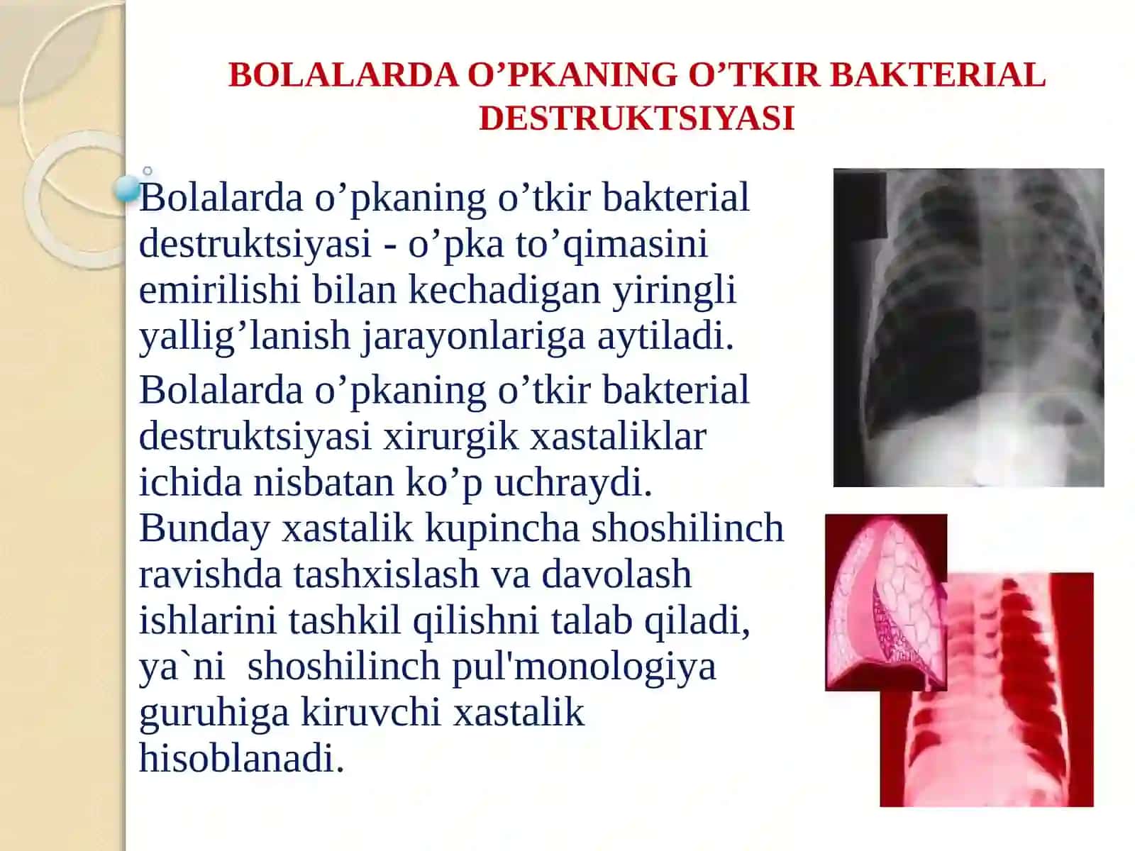 BOLALARDA O’PKА VА PLЕVRАNING YIRINGLI YALLIG’LАNISH KАSАLLIKLАRI 2