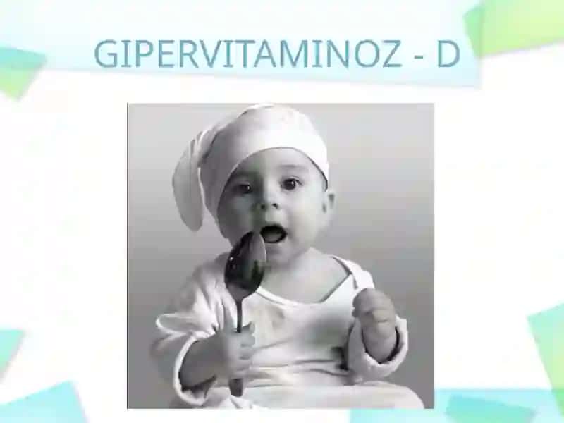 Gipervitaminoz-D 2