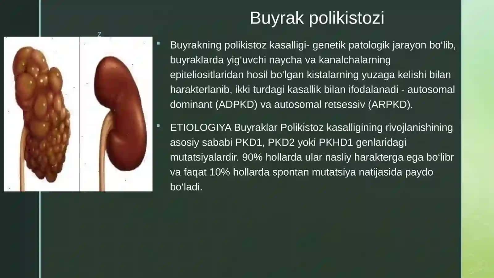Nasliynefropatiyalar:buyrakpolikistozi,Gudpaschersindromi, Alportsindromi 2